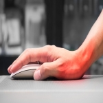 A Complete Insight on Carpal Tunnel Syndrome