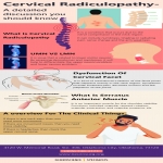 Cervical Radiculopathy- A Detail Discussion You Should Know