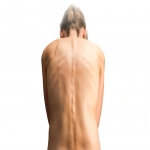 How Scoliosis Specialist Near You Can Help You With the Treatment