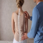 Scoliosis and Kyphosis: Exploring the Thin Line